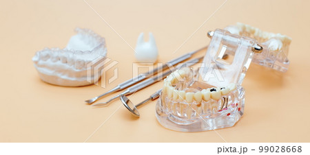 Orthodontic dental theme on yellow background.Transparent invisible dental aligners or braces aplicable for an orthodontic dental treatment Orthodontic dental theme on yellow background.Transparent invisible dental aligners or braces aplicable for an orthodontic dental treatment 99028668