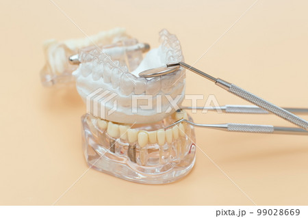 Orthodontic dental theme on yellow background.Transparent invisible dental aligners or braces aplicable for an orthodontic dental treatment Orthodontic dental theme on yellow background.Transparent invisible dental aligners or braces aplicable for an orthodontic dental treatment 99028669