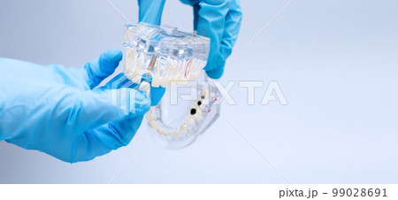 In hand dentists dental teeth teaching model showing each tooth, gum, root, implant, decay, plaque and enamel. 99028691