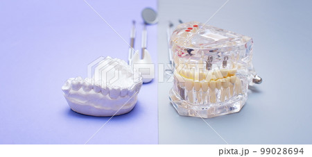 Dental tools and model of teeth on a blue background. Dental care concept. Invisible braces Dental tools and model of teeth on a blue background. Dental care concept. Invisible braces 99028694
