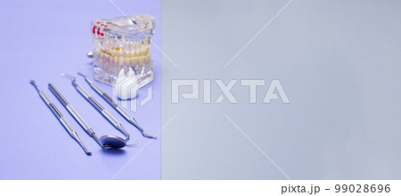 Dental tools and model of teeth on a blue background. Dental care concept. Invisible braces 99028696