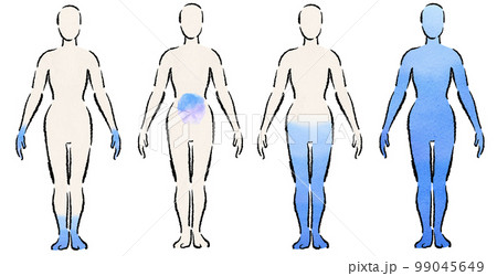 さまざまな冷えの症状を描いたイラスト　背景透明　東洋医学 99045649