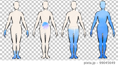 さまざまな冷えの症状を描いたイラスト　背景透明　東洋医学 99045649