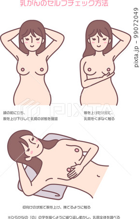 乳がんのセルフチェック方法 乳がんのセルフチェック方法 99072049