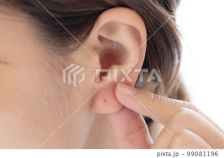 ピアス穴を開けた耳のイメージ 99081196