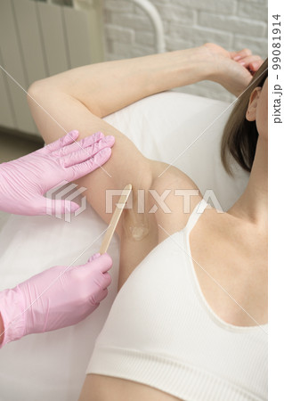 woman gets ready for laser epilation procedure, applying conductive gel for depilation. unrecognizable people, vertical. beauty body care at professional spa center. woman gets ready for laser epilation procedure, applying conductive gel for depilation. unrecognizable people, vertical. beauty body care at professional spa center. 99081914