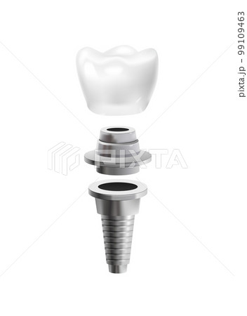 Dental Post Icon 99109463