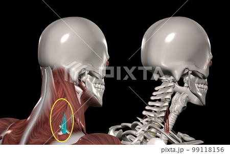 人体の頚部筋肉（後斜角筋） 99118156