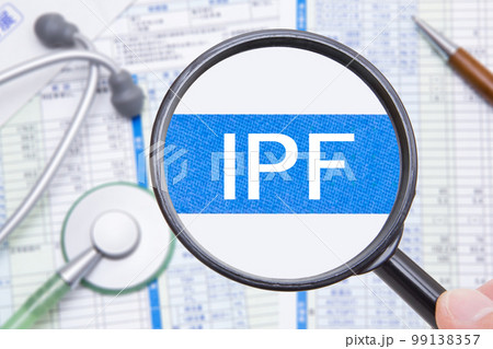 IPF（特発性肺線維症） 99138357
