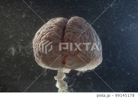 Brain floating in a tank of water Brain floating in a tank of water 99145178