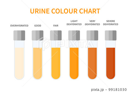 Urine color chart illustration of dehydration level Urine color chart illustration of dehydration level 99181030