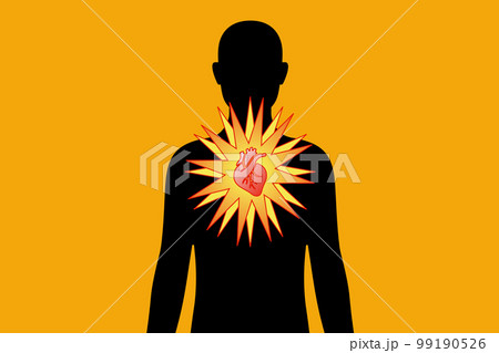 心臓の病気 心臓の病気 99190526