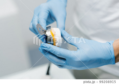 The dentist makes an impression of the teeth. Close-up of a dentist in blue gloves 99208915
