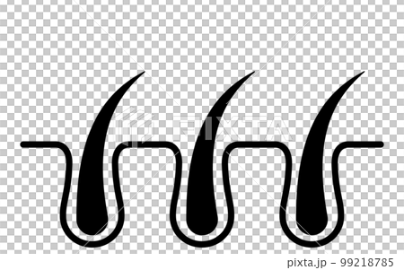 Pore cross section before hair removal, image illustration of hair removal and self-treatment Pore cross section before hair removal, image illustration of hair removal and self-treatment 99218785