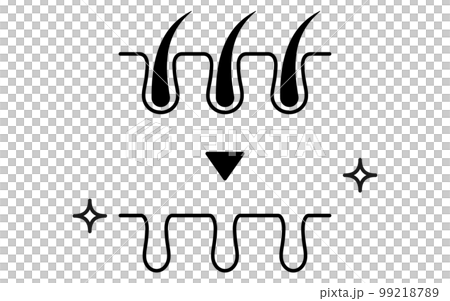 Pore cross section of hair removal, image illustration of hair removal clinic / hair removal salon 99218789