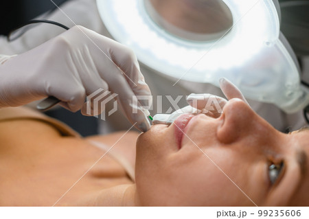 Client lay in cosmetology clinic under lamp Client lay in cosmetology clinic under lamp 99235606