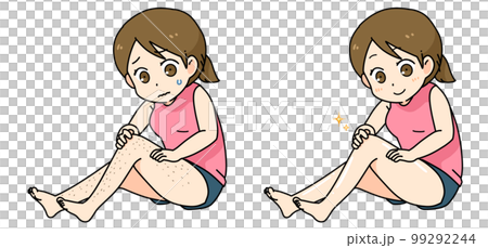 為擔心腿上多餘毛髮的女性脫毛前後 為擔心腿上多餘毛髮的女性脫毛前後 99292244