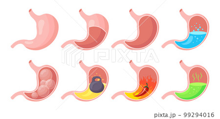 Healthy and unhealthy, empty and full human stomach, icons set. Nutrition, stomach pain, heartburn, heaviness, bloating. Anatomy of the digestive system. vector Healthy and unhealthy, empty and full human stomach, icons set. Nutrition, stomach pain, heartburn, heaviness, bloating. Anatomy of the digestive system. vector 99294016