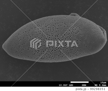 水仙の花粉 電子顕微鏡写真 水仙の花粉 電子顕微鏡写真 99298351