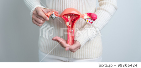 Woman holding Uterus and Ovaries model. Ovarian and Cervical cancer, Cervix disorder, Endometriosis, Hysterectomy, Uterine fibroids, Reproductive system and Pregnancy concept 99306424
