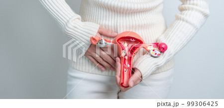 Woman holding Uterus and Ovaries model. Ovarian and Cervical cancer, Cervix disorder, Endometriosis, Hysterectomy, Uterine fibroids, Reproductive system and Pregnancy concept Woman holding Uterus and Ovaries model. Ovarian and Cervical cancer, Cervix disorder, Endometriosis, Hysterectomy, Uterine fibroids, Reproductive system and Pregnancy concept 99306425