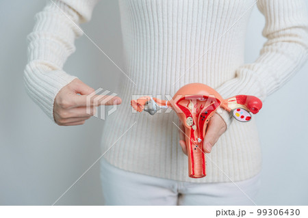 Woman holding Uterus and Ovaries model. Ovarian and Cervical cancer, Cervix disorder, Endometriosis, Hysterectomy, Uterine fibroids, Reproductive system and Pregnancy concept 99306430
