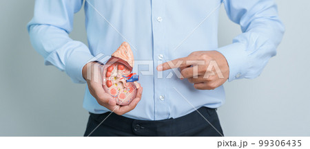 Man holding Anatomical human kidney Adrenal gland model. disease of Urinary system and Stones, Cancer, world kidney day, Chronic kidney and Organ Donor Day concept Man holding Anatomical human kidney Adrenal gland model. disease of Urinary system and Stones, Cancer, world kidney day, Chronic kidney and Organ Donor Day concept 99306435
