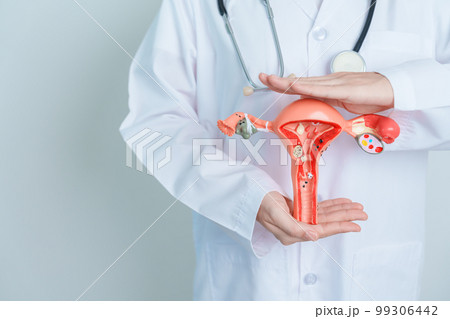 Doctor holding Uterus and Ovaries model. Ovarian and Cervical cancer, Cervix disorder, Endometriosis, Hysterectomy, Uterine fibroids, Reproductive system and Pregnancy concept 99306442