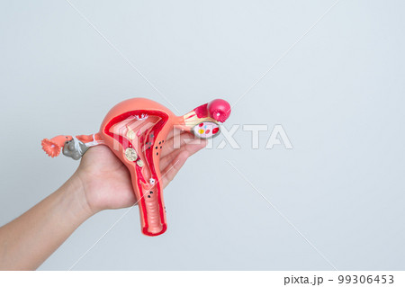 Woman holding Uterus and Ovaries model. Ovarian and Cervical cancer, Cervix disorder, Endometriosis, Hysterectomy, Uterine fibroids, Reproductive system and Pregnancy concept 99306453
