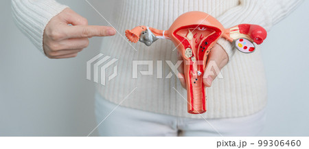 Woman holding Uterus and Ovaries model. Ovarian and Cervical cancer, Cervix disorder, Endometriosis, Hysterectomy, Uterine fibroids, Reproductive system and Pregnancy concept Woman holding Uterus and Ovaries model. Ovarian and Cervical cancer, Cervix disorder, Endometriosis, Hysterectomy, Uterine fibroids, Reproductive system and Pregnancy concept 99306460