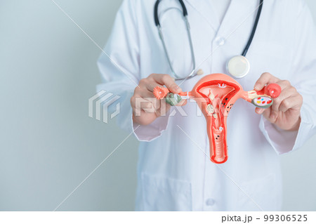 Doctor holding Uterus and Ovaries model. Ovarian and Cervical cancer, Cervix disorder, Endometriosis, Hysterectomy, Uterine fibroids, Reproductive system and Pregnancy concept 99306525