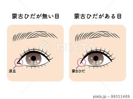 蒙古ひだがある目と無い目 99311489