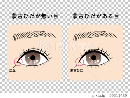 蒙古ひだがある目と無い目 99311489