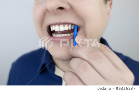 Interdental brush. A man shows a brush for cleaning the interdental space. Brush for cleaning teeth and daily oral care. Dentistry and orthodontics  99326537