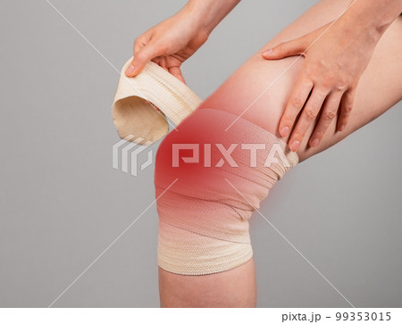 Woman wrapping elastic bandage around painful knee to relieve pain or prevent injury. Female suffering from leg discomfort. Sprained ligaments, torn cartilage. Woman wrapping elastic bandage around painful knee to relieve pain or prevent injury. Female suffering from leg discomfort. Sprained ligaments, torn cartilage. 99353015