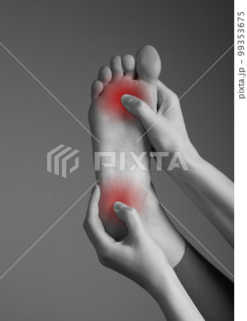 Toe and heel pain caused by plantar fasciitis, arthritis, diabetes, tendinitis, spurs, bruise, fracture. Woman hands holding foot with red spot. Black and white. Toe and heel pain caused by plantar fasciitis, arthritis, diabetes, tendinitis, spurs, bruise, fracture. Woman hands holding foot with red spot. Black and white. 99353675