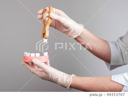 Dentist hands pulling tooth with forceps out of jaw model. Teeth removal, dentistry concept. Dental diseases treatment. 99353707