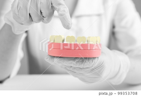 Dentist forefinger pointing to yellow teeth at jaw model. Dental plaque removal and treatment, cavity, decay prevention. Poor oral care habits, stomatology concept Dentist forefinger pointing to yellow teeth at jaw model. Dental plaque removal and treatment, cavity, decay prevention. Poor oral care habits, stomatology concept 99353708