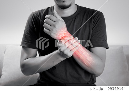 Man with osteoporosis symptoms in the arm. Man with osteoporosis symptoms in the arm. 99369144