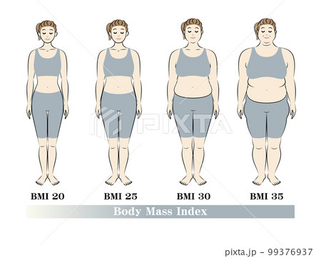 ボディマスインデックス 若い女性の体形変化 ダイエットのビフォーアフター イラスト ベクター 99376937