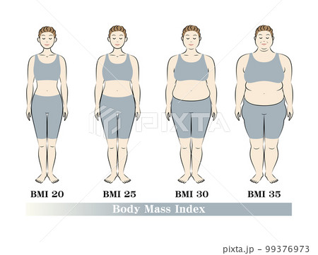 ボディマスインデックス 中高年女性の体形変化 ダイエットのビフォーアフター イラスト ベクター 99376973