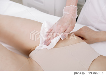 Cosmetologist wearing medical gloves removes agent gel from the client's bikini area. Close up. hair removal in a professional beauty salon Cosmetologist wearing medical gloves removes agent gel from the client's bikini area. Close up. hair removal in a professional beauty salon 99386963