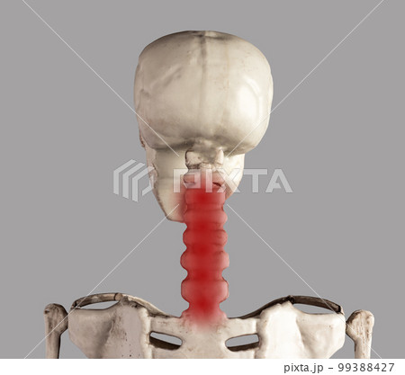 Human skeleton cervical vertebrate with red point. Neck pain, stiffness. Inflammation, injury, poor posture, overuse consequences. Health problems, anatomy concept. Human skeleton cervical vertebrate with red point. Neck pain, stiffness. Inflammation, injury, poor posture, overuse consequences. Health problems, anatomy concept. 99388427