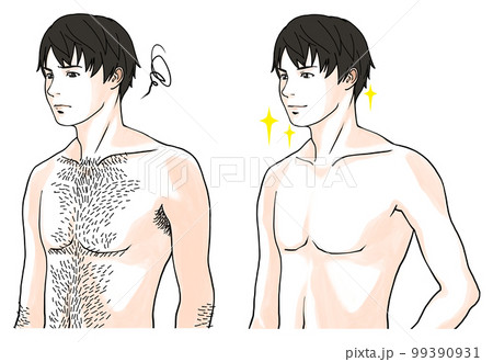 体毛に悩む男性のビフォーアフターのイラスト4 99390931