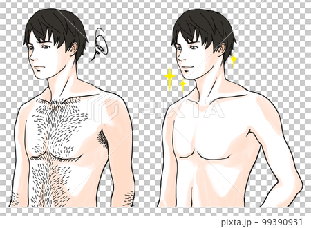 体毛に悩む男性のビフォーアフターのイラスト4 99390931
