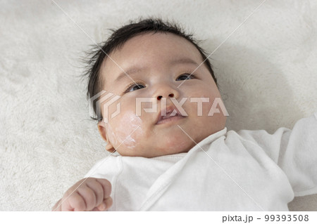 塗り薬を塗られた赤ちゃんのイメージ（0歳2か月、日本人、男の子） 99393508