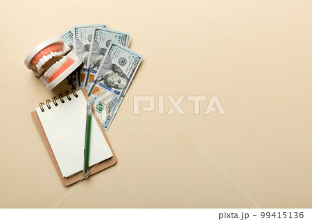 Flat lay composition with educational dental typodont model and money with notebook on colored table, top view. Expensive treatment 99415136