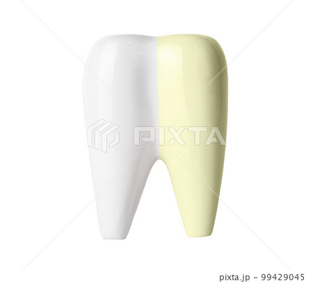 Tooth whitening before and after isolated on white background. Professional teeth cleaning and bleaching, dental care and oral hygiene concept. High quality photo 99429045