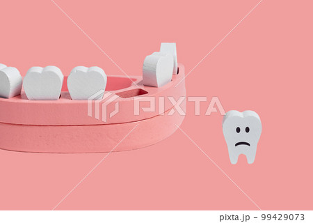 Teeth loss concept. Wooden jaw model with missing or extracted tooth with sad emoji on pink background. Poor oral hygiene, dental problems concept. High quality photo Teeth loss concept. Wooden jaw model with missing or extracted tooth with sad emoji on pink background. Poor oral hygiene, dental problems concept. High quality photo 99429073