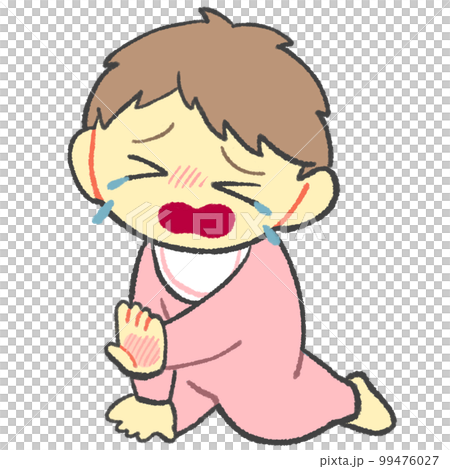 怪我、火傷をして泣いている赤ちゃん 99476027